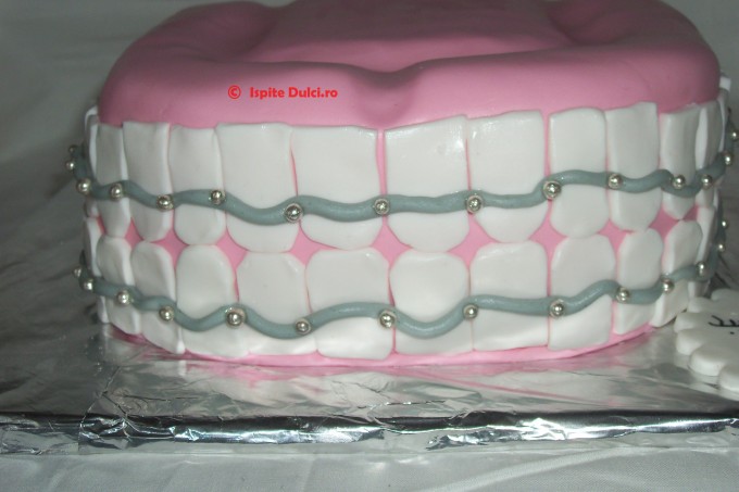 Tort proteza si tort cu aparat dentar