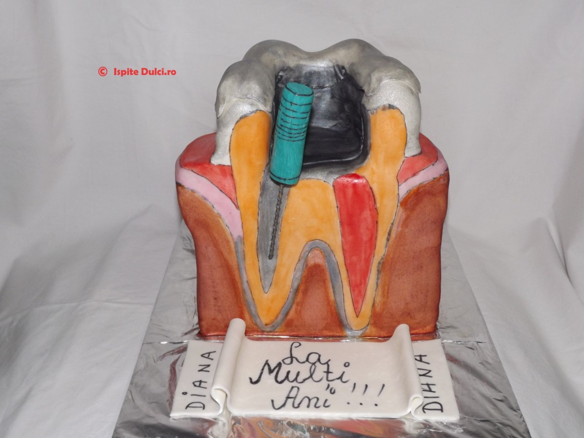 Tort masea cariata