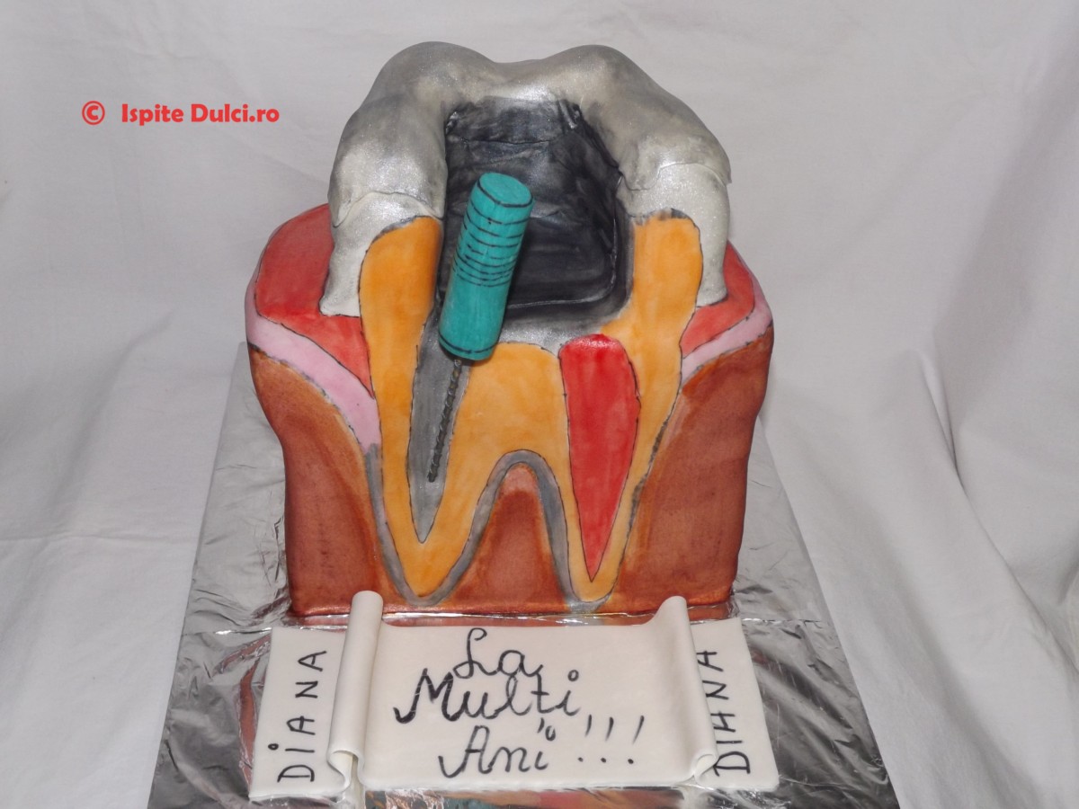 Tort masea cariata