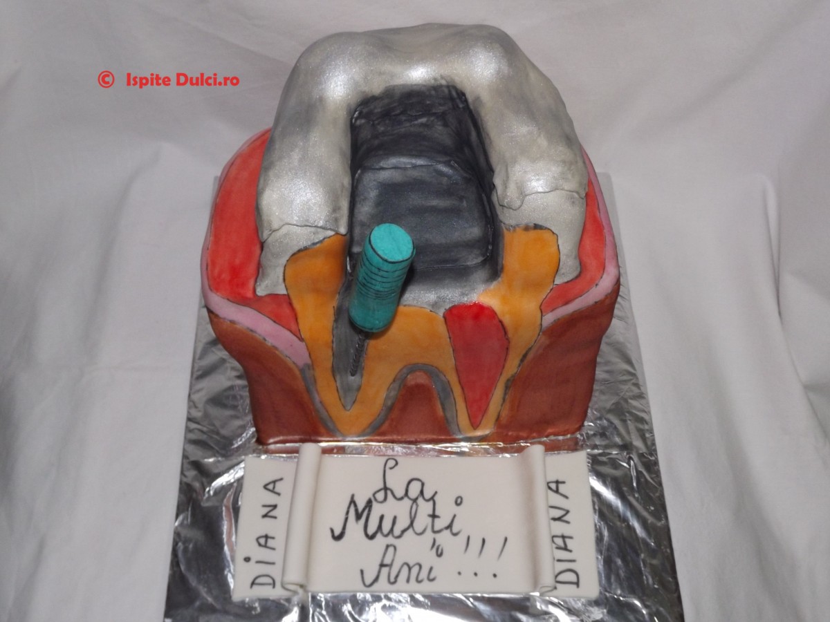Tort masea cariata